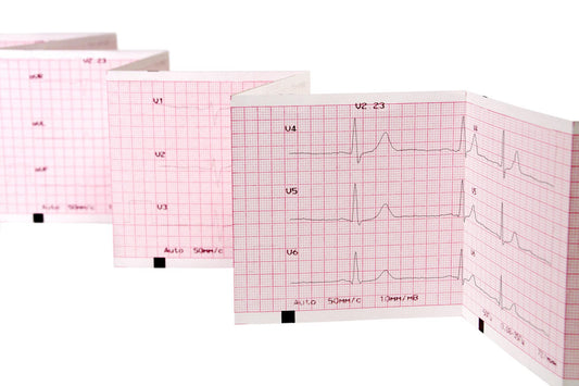 ECG Recording Paper Z Fold